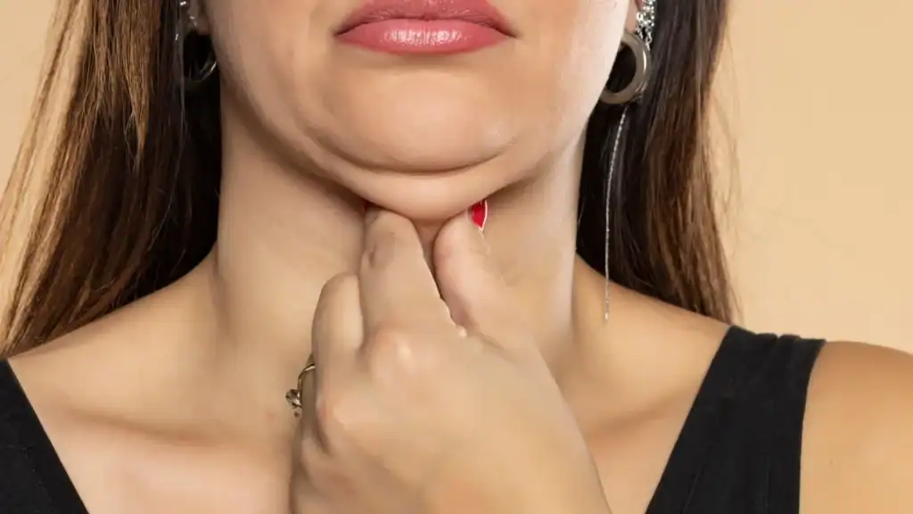 An image of a woman with double chin, sad, worried : Non Surgical Double Chin Removal Treatment in Warrington, UK