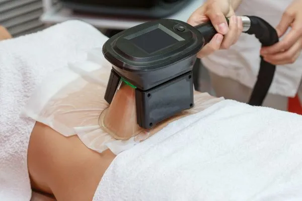 Image of person having fat freezing treatment to help weight gain Warrington