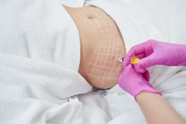image of fat dissolving injections on love handles to help combat weight gain Warrington