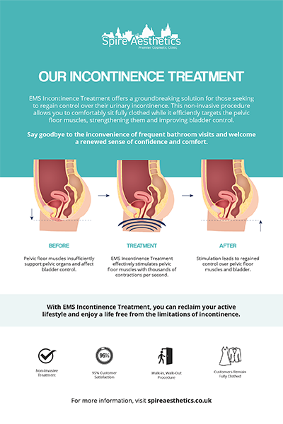 image of how urge incontinence Warrington treatment works