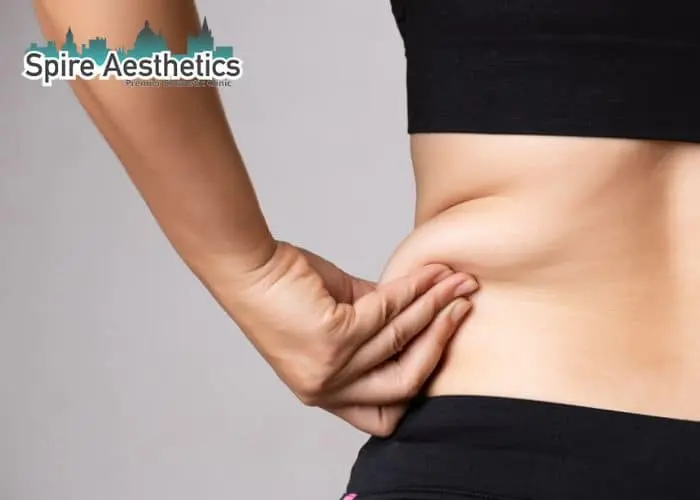Image of woman pinching fat on their hips Warrington. Fat Freezing treatment