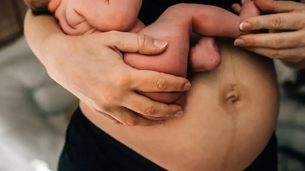 Why Is My Stomach Still Big After Pregnancy Warrington?